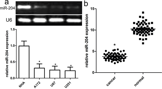 Reduced miR-204 expression in GBM cell lines and tissues.