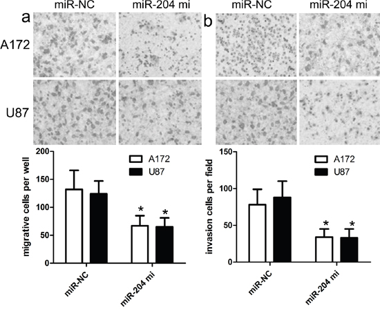 miR-204 inhibits GBM cell migration and invasion.