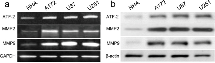 ATF2, MMP2 and MMP9 were up-regulated in GBM cell lines and NHA cells.