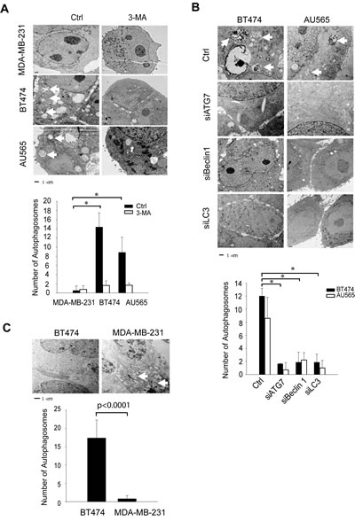 TEM images reveals autophagosome structures in TRAIL-resistant cell lines and xenograft tumor models.