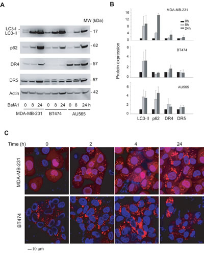 Inhibition of lysosomal activity induces differentially accumulation of autophagosome in MDA-MB-231 and TRAIL-resistant cell lines.