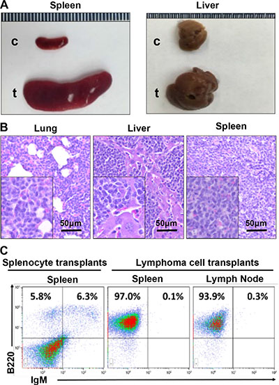 p18&#x2212;/&#x2212;;Gata3+/&#x2212; lymphoma cells are transplantable.