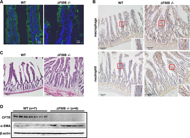 &#x0394;F508 mutation leads to intestinal inflammation in mice.