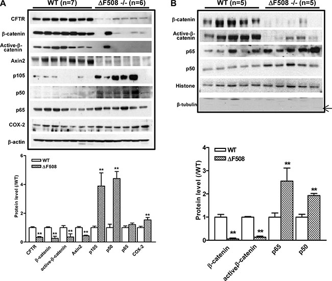 Aberrant activation of NF-&#x03BA;B and suppression of &#x03B2;-catenin pathways in &#x0394;F508cftr&#x2212;/&#x2212; mouse small intestine.