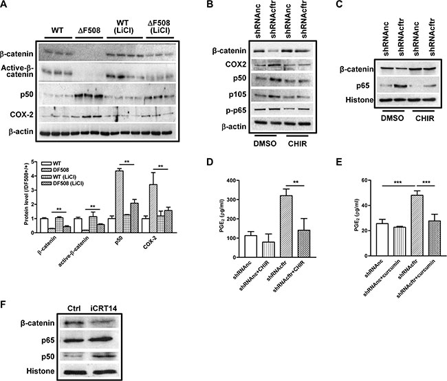 &#x03B2;-catenin inhibits NF-&#x03BA;B activity in &#x0394;F508 cftr&#x2212;/&#x2212; mouse intestine and Caco-2 cells.