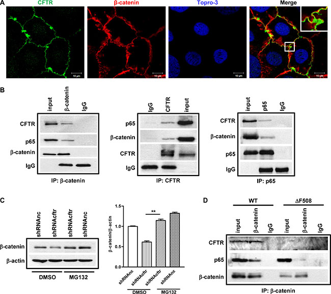 CFTR interacts with &#x03B2;-catenin and prevents its degradation in Caco-2 cells and mouse small intestine.