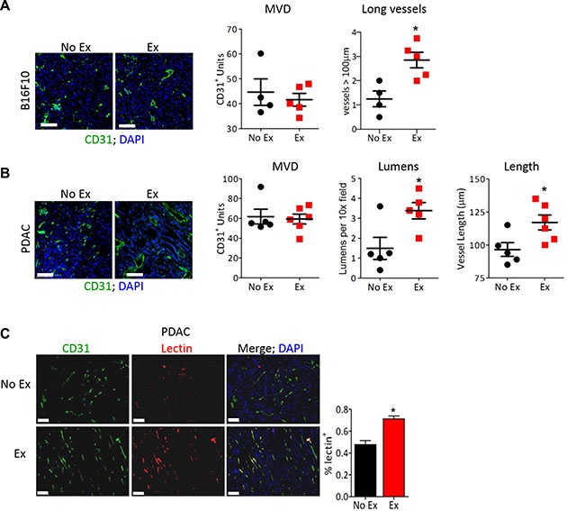 Exercise normalizes tumor vasculature.