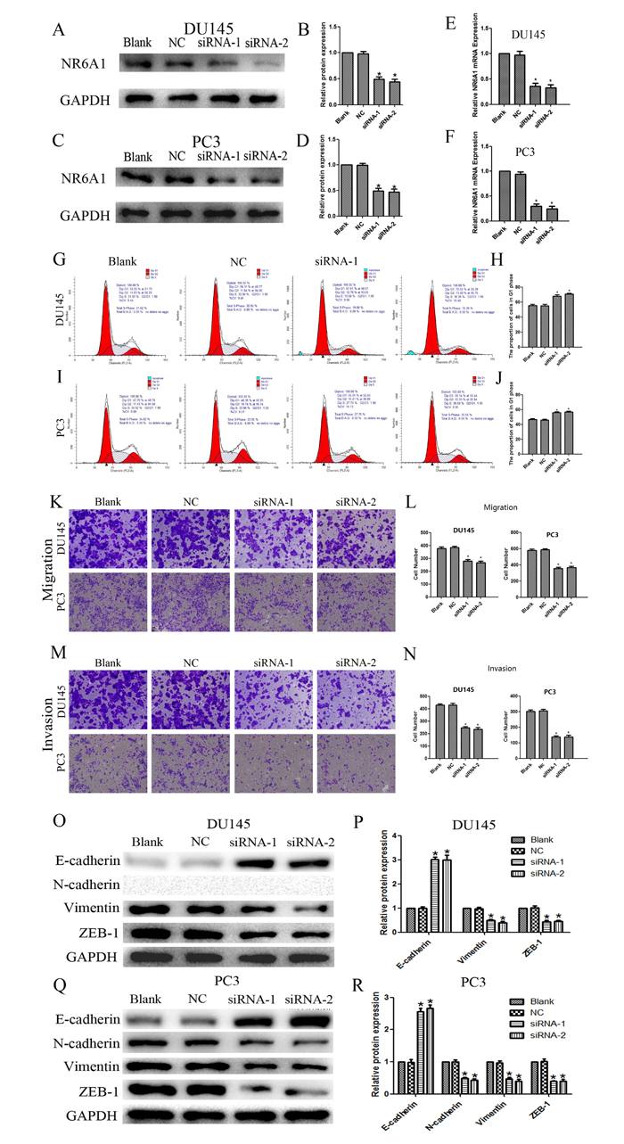 (A)(B) NR6A1 protein expression after 48 hours of transfection with NR6A1 siRNA or NC in DU145.