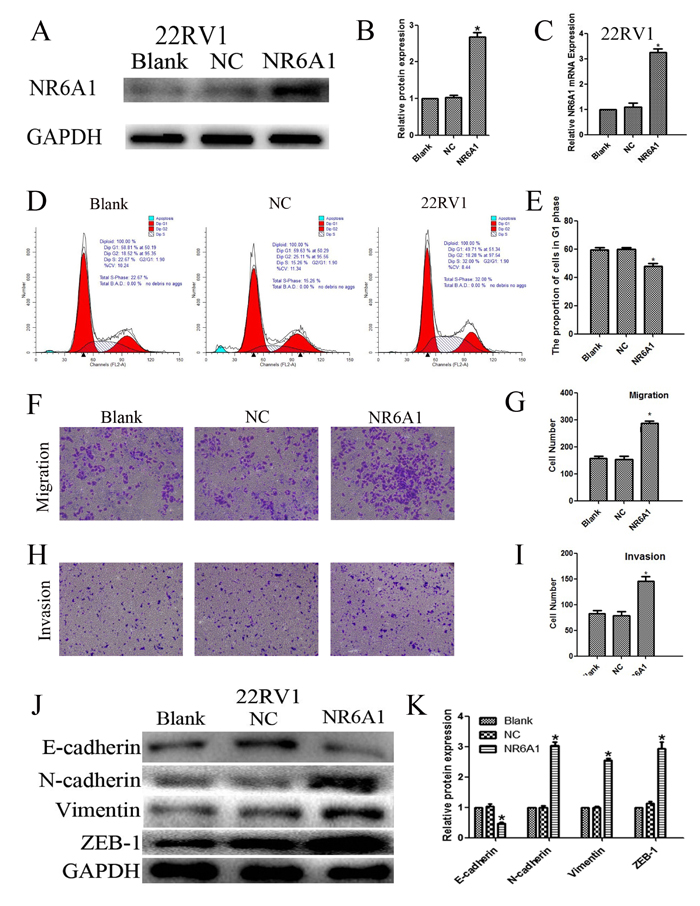 (A)(B) NR6A1 protein expression of transfection with NR6A1 lentivirus or NC in 22RV1.