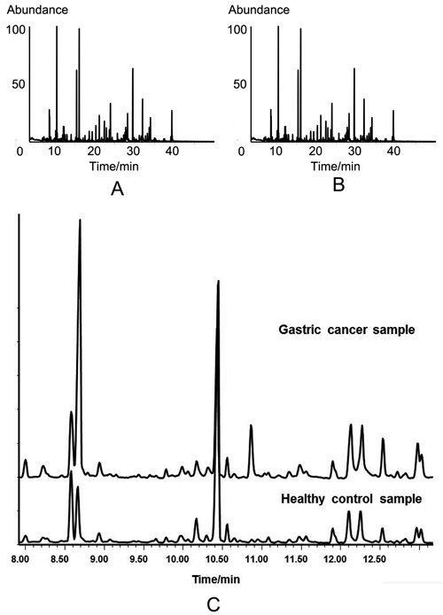 TIC chromatograms of urine samples from different groups by GC-MS analysis.