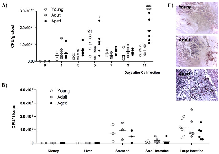 Yeast load in mice stools and target organs.