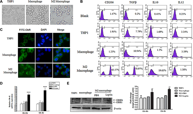 Leptin stimulated ObR expression in M2 macrophages.