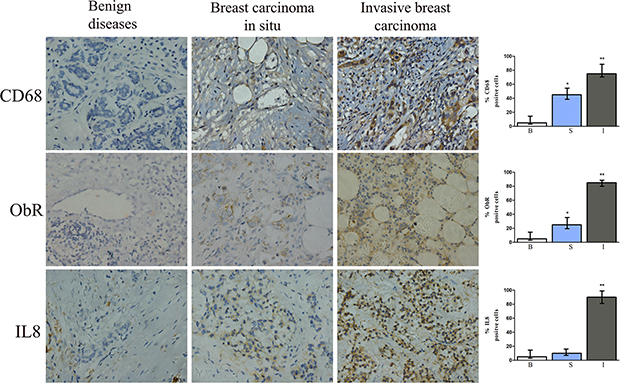 Immunohistochemical staining for CD68, ObR, and IL-8 of human breast tissue specimens.