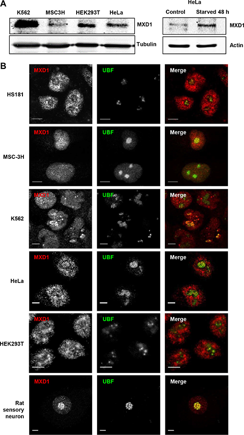 Endogenous MXD1 localizes in the nucleolus.