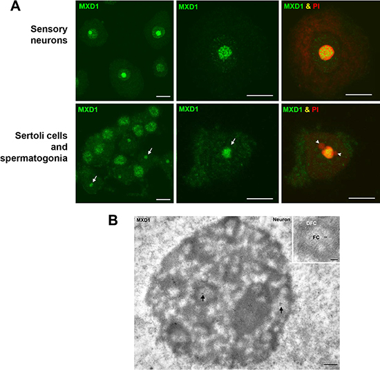 MXD1 expression in rat primary cells.