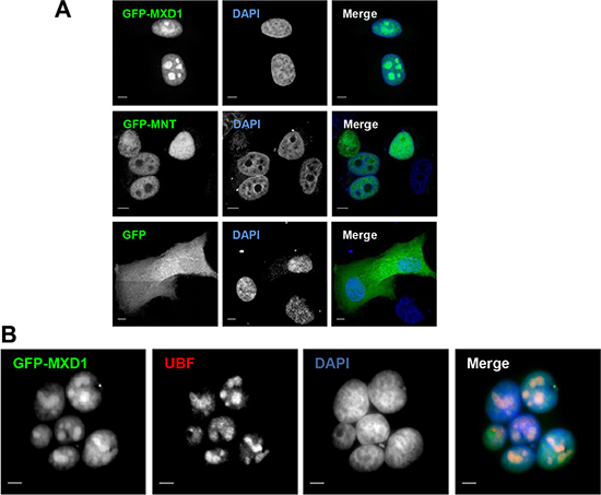 Ectopic MXD1 localizes in nucleoli.