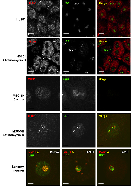 Nucleolar segregation of MXD1 by actinomycin D treatment.