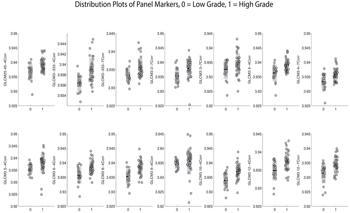 Distribution plots characterizing the performance of individual Gray Level Co-Occurrence Matrix (GLCM) panel markers and their ability to discriminate between high grade and low grade IPMNs.