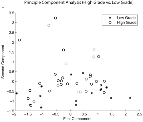 Principle component analysis (PCA) demonstrating a pattern of separation of between high grade and low grade IPMNs.