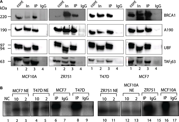 Active components of Pol-I transcription machinery co-immunoprecipitate with BRCA1.