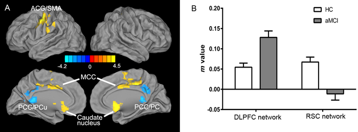 Differential intrinsic functional connectivities in the DLPFC and RSC networks in the aMCI group compared to the HC group (two-sample