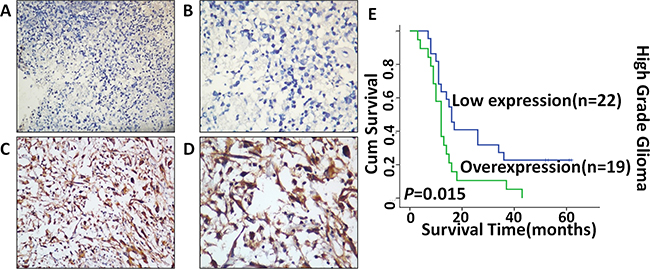 Expression of c-Fos in malignant glioma tissues detected by immunohistochemistry staining and Kaplan&#x2013;Meier estimates of survival probability.