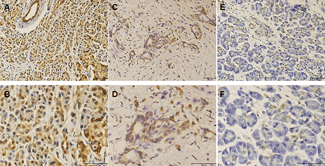 Immunohistochemical staining for ADAM10.