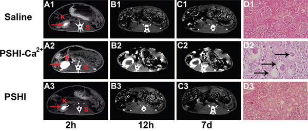 CT scans of normal rabbits at predetermined intervals after embolization using saline (A1-C1), PSHI-Ca2+ (A2-C2) and PSHI (A3-C3).