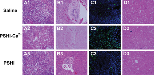 Histopathological H&#x0026;E staining, TUNEL assay and toluidine blue-eosin staining set of tumor and embolic arterial sections after treatment with saline (A1-D1), PSHI-Ca2+ (A2-D2) and PSHI (A3-D3) (original magnification&#x00D7;100).