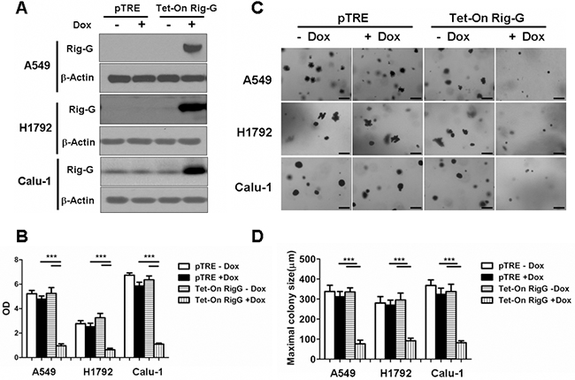 Rig-G inhibits lung cancer cell growth.