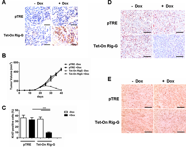 Rig-G protein results in decreased tumor growth in vivo.