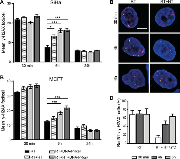 Persisting ionizing radiation induced foci (IRIF) in SiHa and MCF7 cells after radiation treatment combined with DNA-PKcsi and HT.