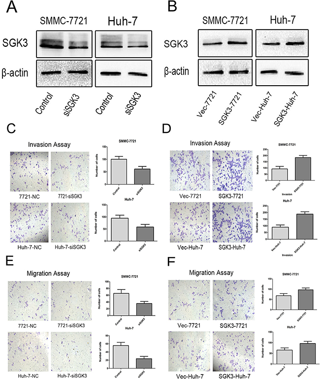 SGK3 promotes cell migration and invasive potential.