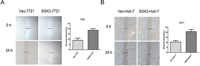 Overexpression of SGK3 promotes wound-healing capacity of HCC cells.