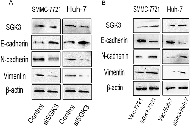 SGK3 regulates the expression of epithelial and mesenchymal markers.