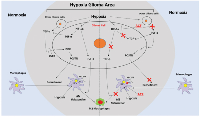 Schematic representation of the recruitment of TAMs and their M2 polarization in hypoxic glioma areas and a description of a mechanism by which ACF may alter these two processes.