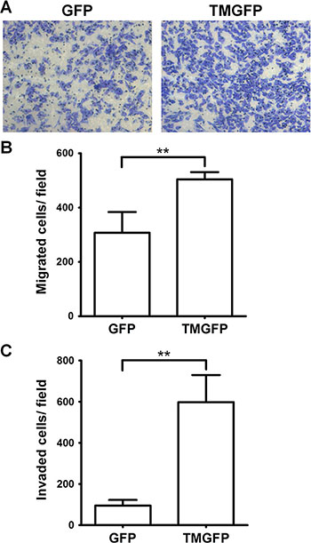 Exogenous expression of TM enhances cell migration and invasion.