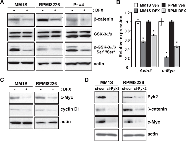 DFX treatment and Pyk2 silencing lead to suppression of the Wnt/&#x03B2;-catenin signaling pathway.