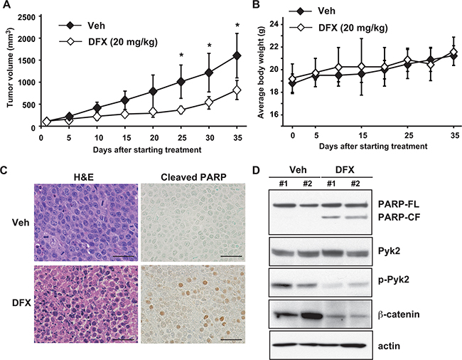 DFX inhibits tumor growth in a mouse xenograft model of MM.