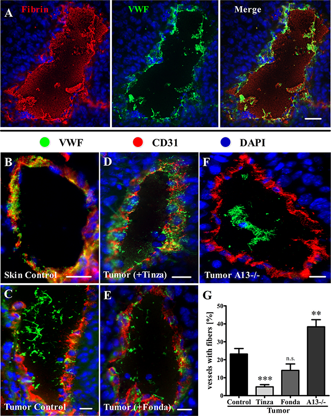 Tinzaparin reduces VWF fiber generation in tumor blood vessels more efficiently than Fondaparinux.