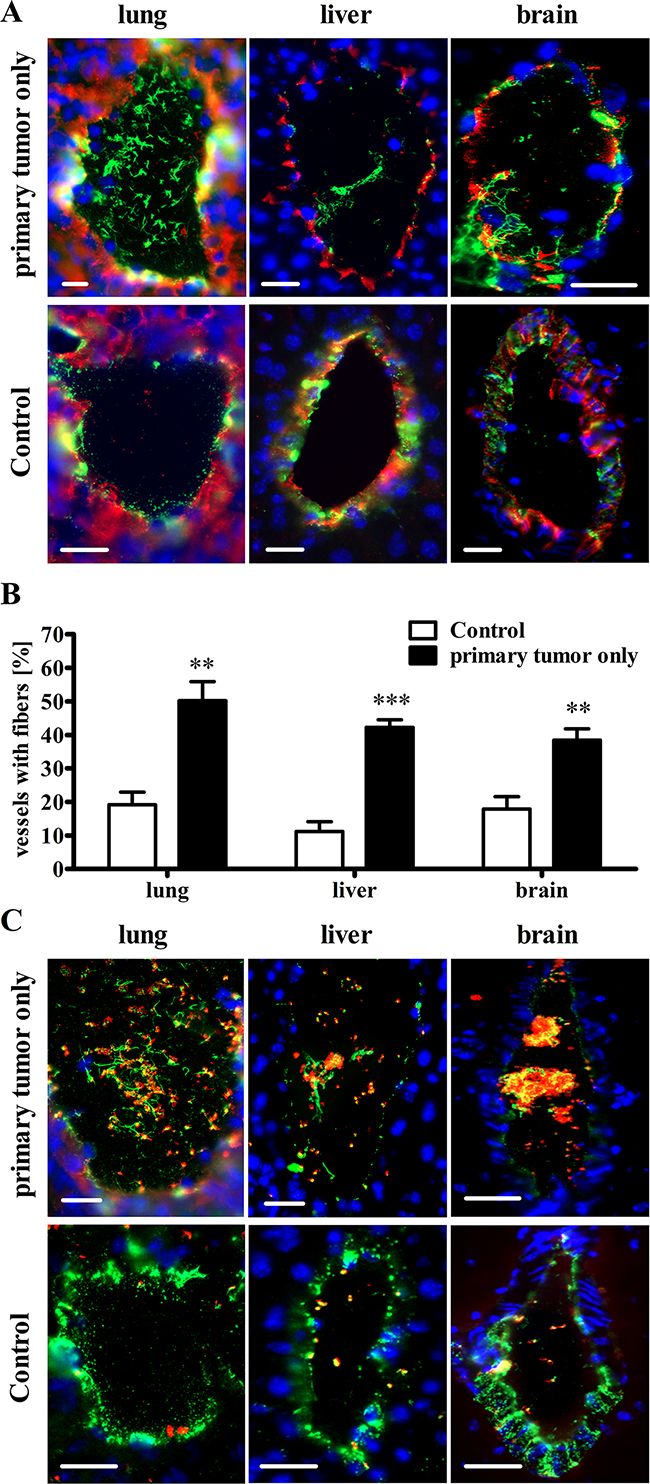 The primary tumor mediates activation of the vascular endothelium and VWF fiber formation in the microvasculature of distal organs without metastases.