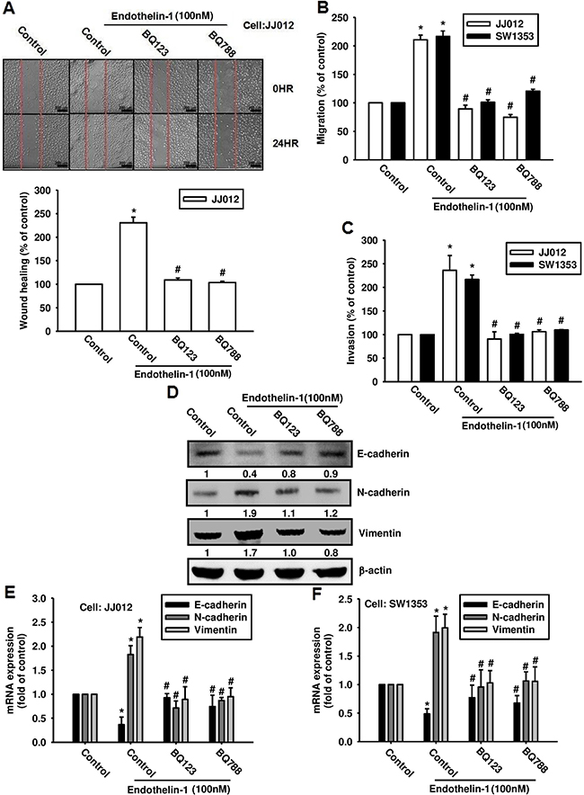 ET-1 promotes cell migration and EMT through ETRs.