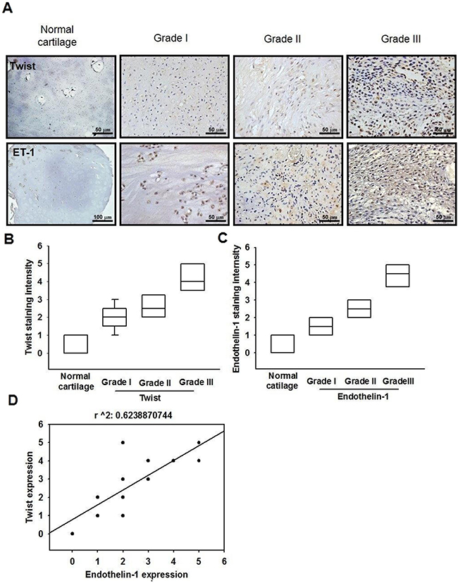 The correlation of ET-1, Twist and tumor stages in human chondrosarcoma tissues.