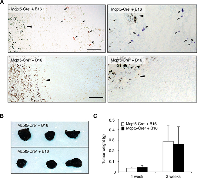 Mast cells do not influence the growth of subcutaneous melanoma tumors.