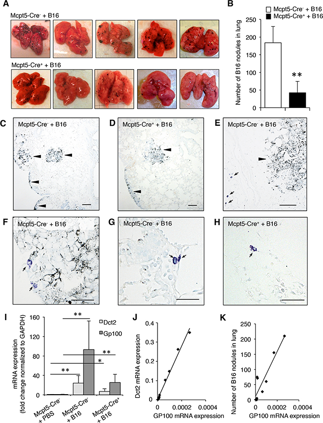 Reduced melanoma colonization in lungs from Mcpt5-Cre+ vs. Mcpt5-Cre- mice.