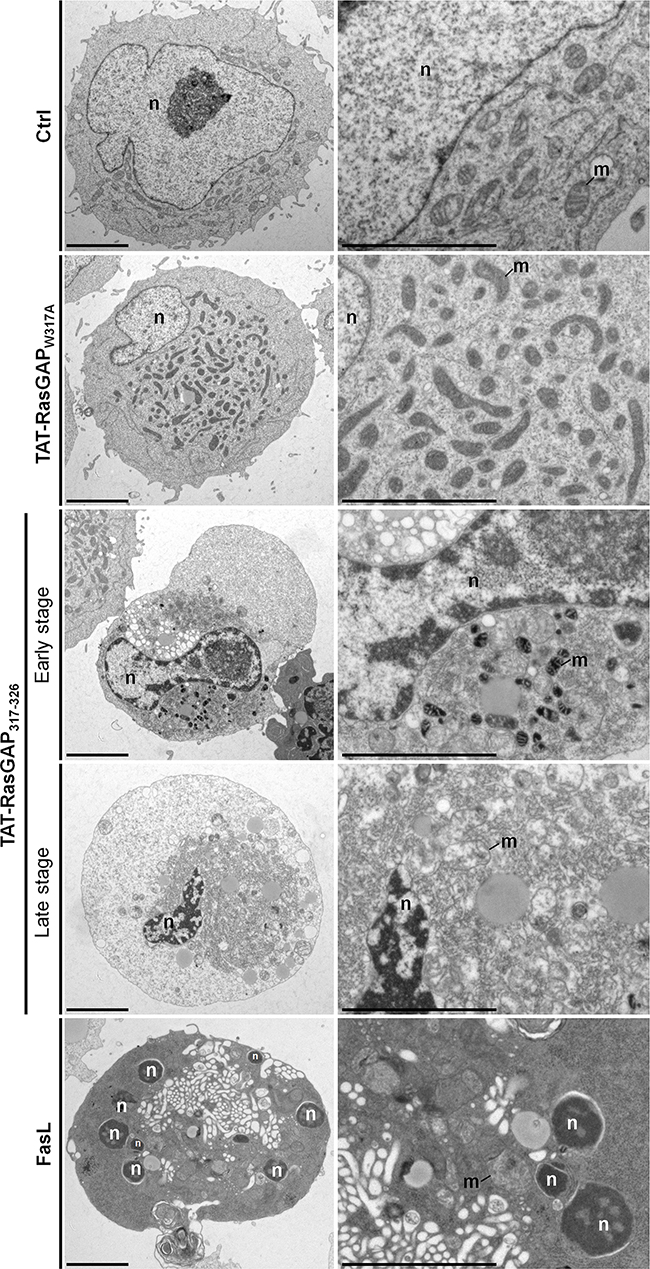 Ultrastructural analysis of TAT-RasGAP317-326-induced cell death in Raji cells.