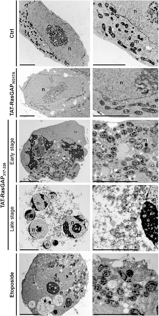 Ultrastructural analysis of TAT-RasGAP317-326-induced cell death in NB1 cells.