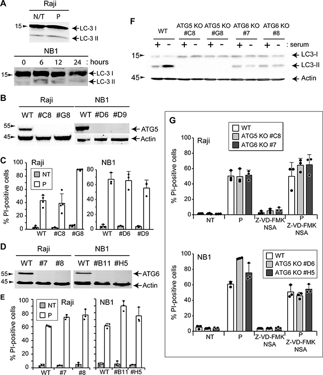 Autophagy is not involved in TAT-RasGAP317-326-induced cell death.