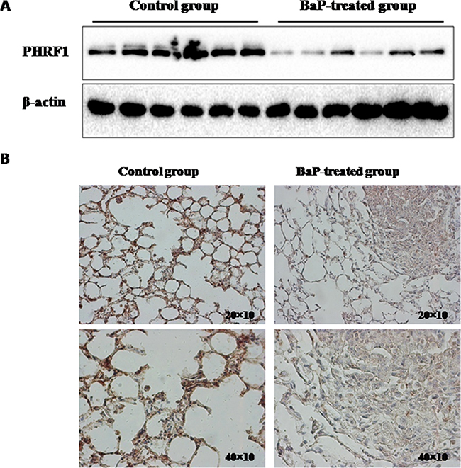 The expression of PHRF1 in BaP-treated mice lung tissues was measured by western blot assay and immunohistochemistry.