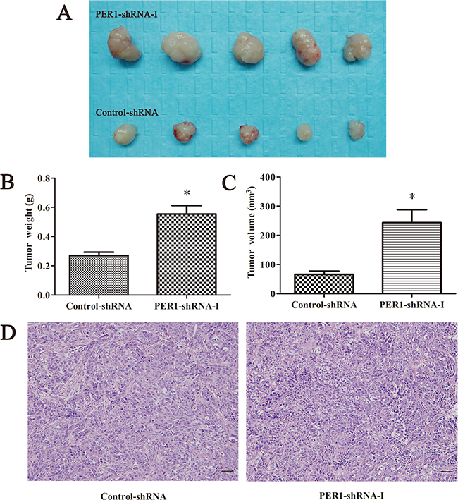 PER1 knockdown enhances the tumorigenic capacity of SCC15 cells in vivo.